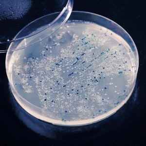 legionella-illustrasjon